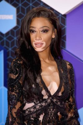Winnie Harlow